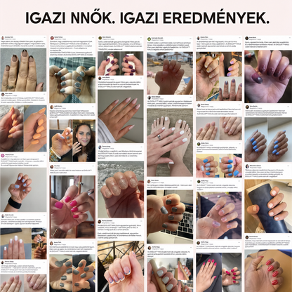 Evolux™ Zselé Körmök — Láb
