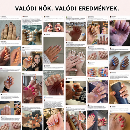 Evolux™ Gél Körömmatrica